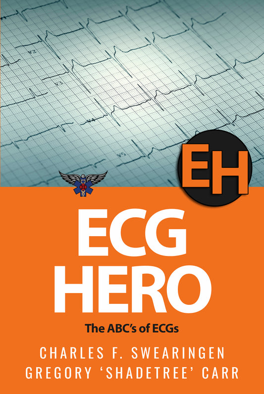 ECG Hero: The ABCs of ECG