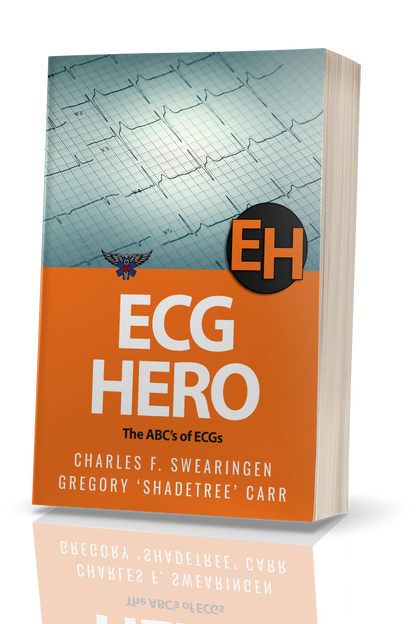ECG Hero: The ABCs of ECG