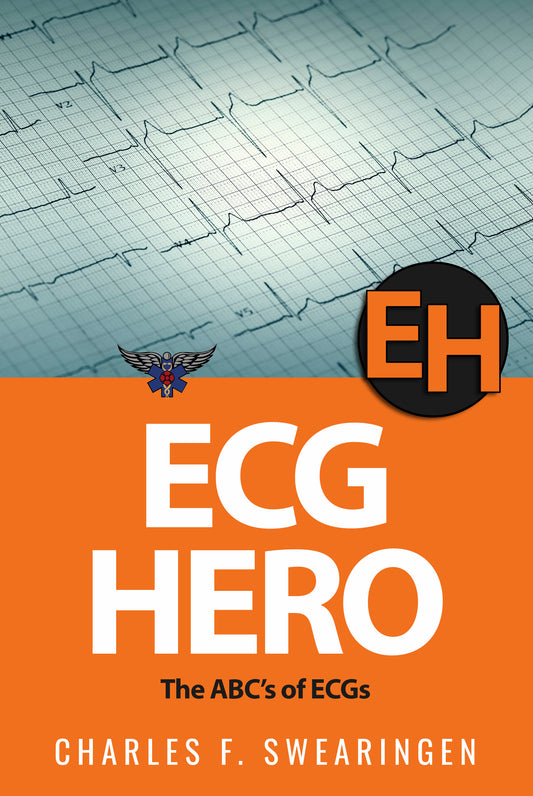 ECG Hero: The ABCs of ECG